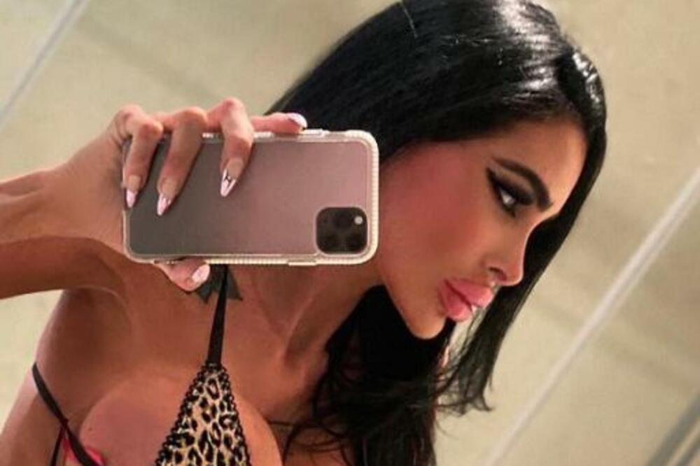 ŠOK! ISPLIVAO KONTROVERZNI MATERIJAL MEDICINSKE SESTRE: Pokazala sve bez zadrške (FOTO)