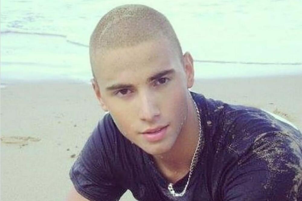 DANAS CEO NADUVEN OD BOTOKSA, A NEKAD APOLON: Ovaj SRBIN je estetskim korekcijama promenio LIČNI OPIS