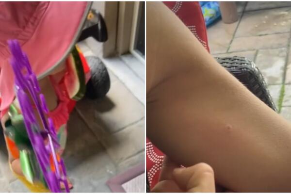 REAKCIJA DVOGODIŠNJE DEVOJČICE NA UBOD STRŠLJENA ŠOKIRALA SVET: Malena pametnija od većine odraslih!