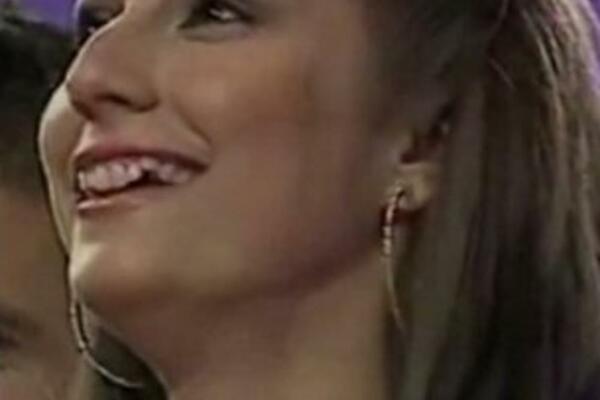 NEKADA TARABE U USTIMA, A SADA NIZ BISERA! Estradne LEPOTICE su za ZUBE dale BRDO NOVCA: Ovo su fotke PRE i POSLE