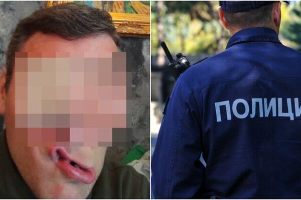 PEVAČ KOJI JE IZBO LJUDE U KRAGUJEVCU NAPAO POLICAJCA I POKUŠAO DA POBEGNE: Odmotava se KLUPKO, NOVE INFORMACIJE!