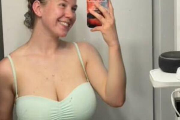 IMALA JE OGROMNE GRUDI I VELIKE PROBLEME ZBOG TOGA: Onda je uzela stvar u svoje ruke i DESILO JOJ SE OVO, AU (FOTO)