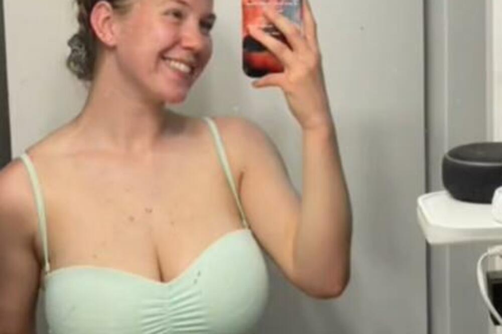 IMALA JE OGROMNE GRUDI I VELIKE PROBLEME ZBOG TOGA: Onda je uzela stvar u svoje ruke i DESILO JOJ SE OVO, AU (FOTO)