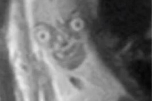 LJUDI DELE STRAVIČAN SNIMAK BEBE IZ STOMAKA: Vidi se i previše, JEZIVO JE (FOTO)