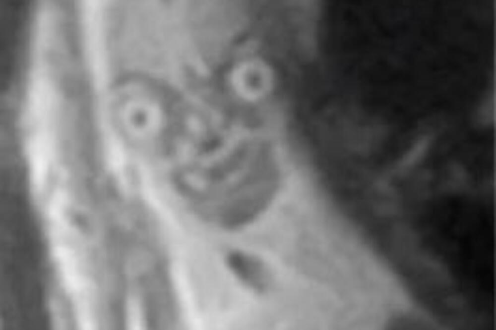 LJUDI DELE STRAVIČAN SNIMAK BEBE IZ STOMAKA: Vidi se i previše, JEZIVO JE (FOTO)