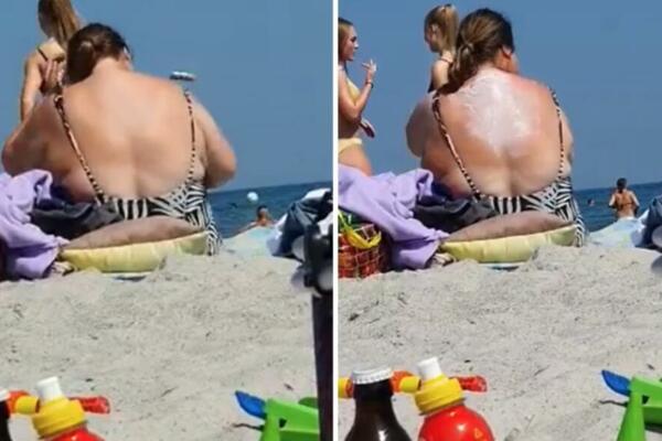 ALAL VERA, SESTRO: Žena na plaži smislila GENIJALAN način da namaže leđa, i MOLERE je preveslala! (VIDEO)