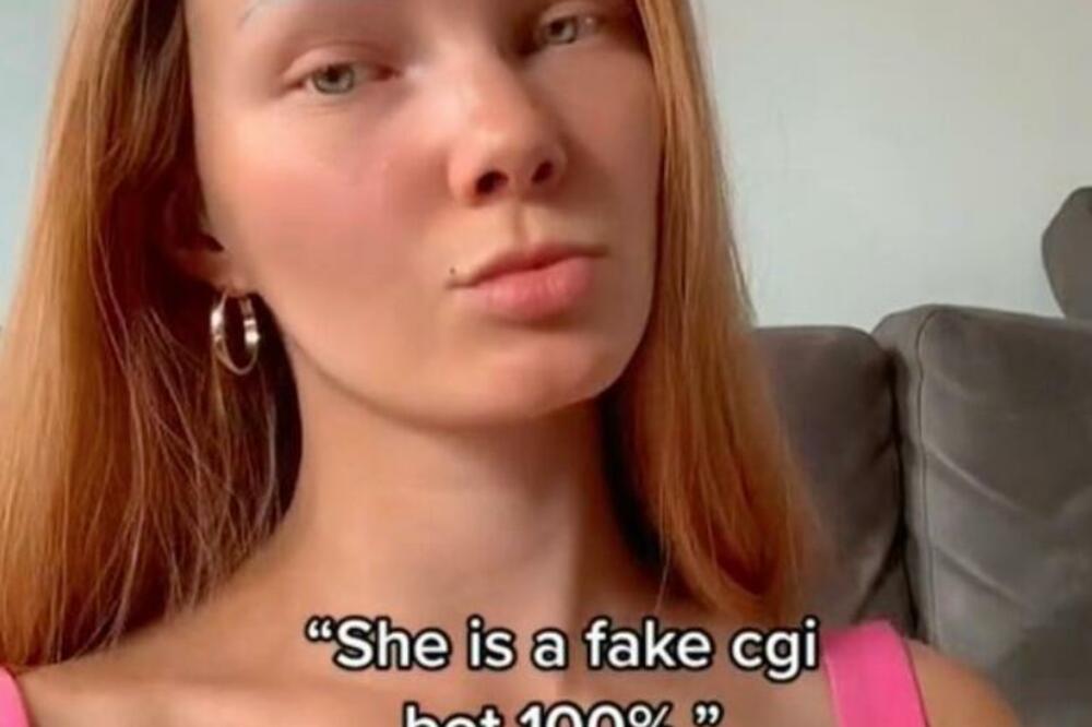 ZBOG ALOPECIJE STAVLJENA NA STUB SRAMA: Pljuštale su UVREDE, govorili su da je kompjuterski generizovan BOT! (FOTO)