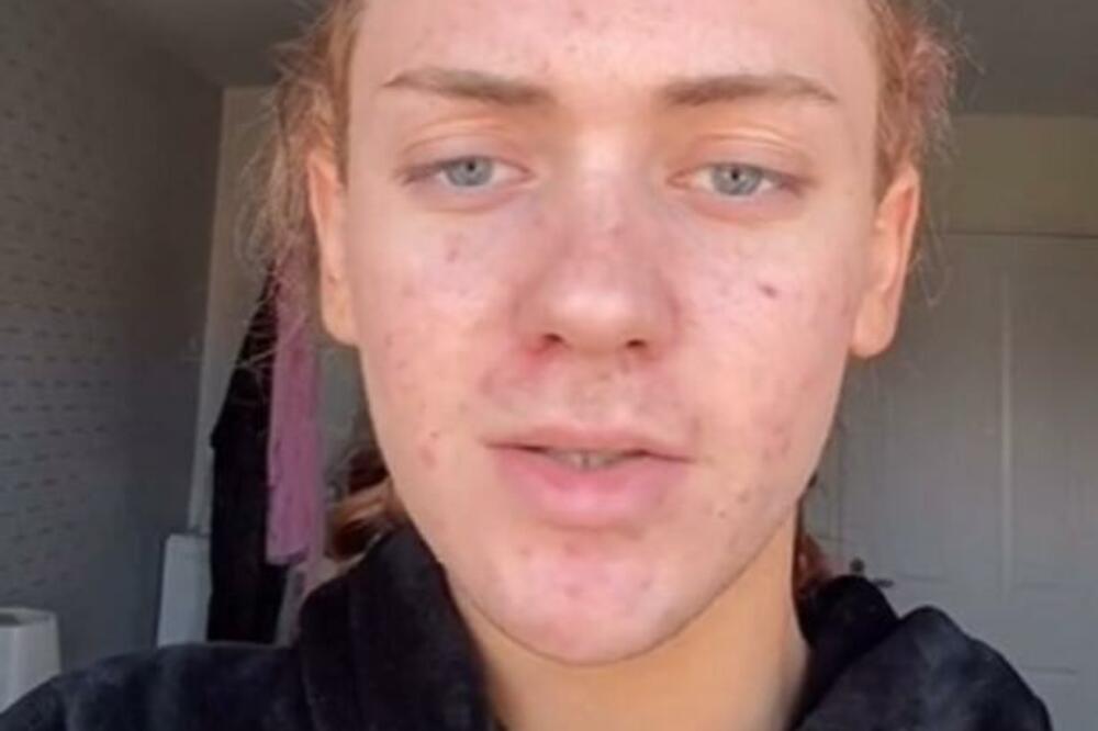 NIJE SVE KAKO SE ČINI: Komplimenti pljušte na sve strane, a ono PREVARA VEKA (FOTO)