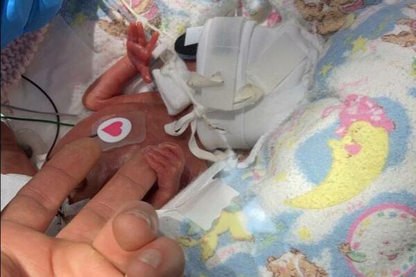 OVAKVA BEBA NIKAD DO SAD NIJE ROĐENA: VELIČINA ove stvari na njoj je frapirala i LEKARE!