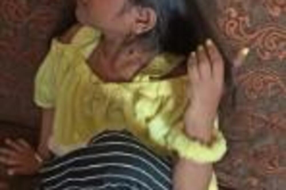 OVA DEVOJKA JE JEDINA ROĐENA BEZ ONOG DOLE: Iz bizarnog razloga niko ne veruje da ima 19 godina! (FOTO)