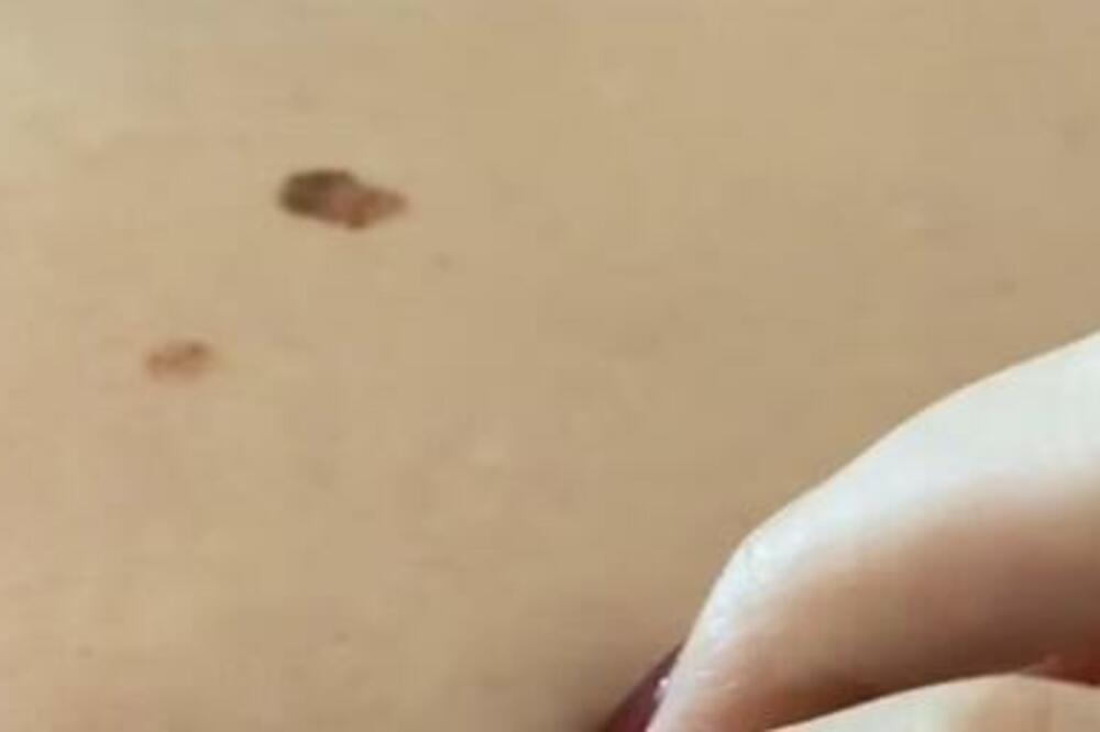 SNIMAO SE ZA TIKTOK I NIJE SHVATAO DA JE U OPASNOSTI: Ugledali su na njemu UŽASNU STVAR (VIDEO)