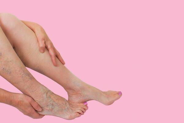 AKO OSETITE OVO U NOGAMA DOK STOJITE, ODMAH ZOVITE LEKARA: Evo koja BOLEST je u pitanju