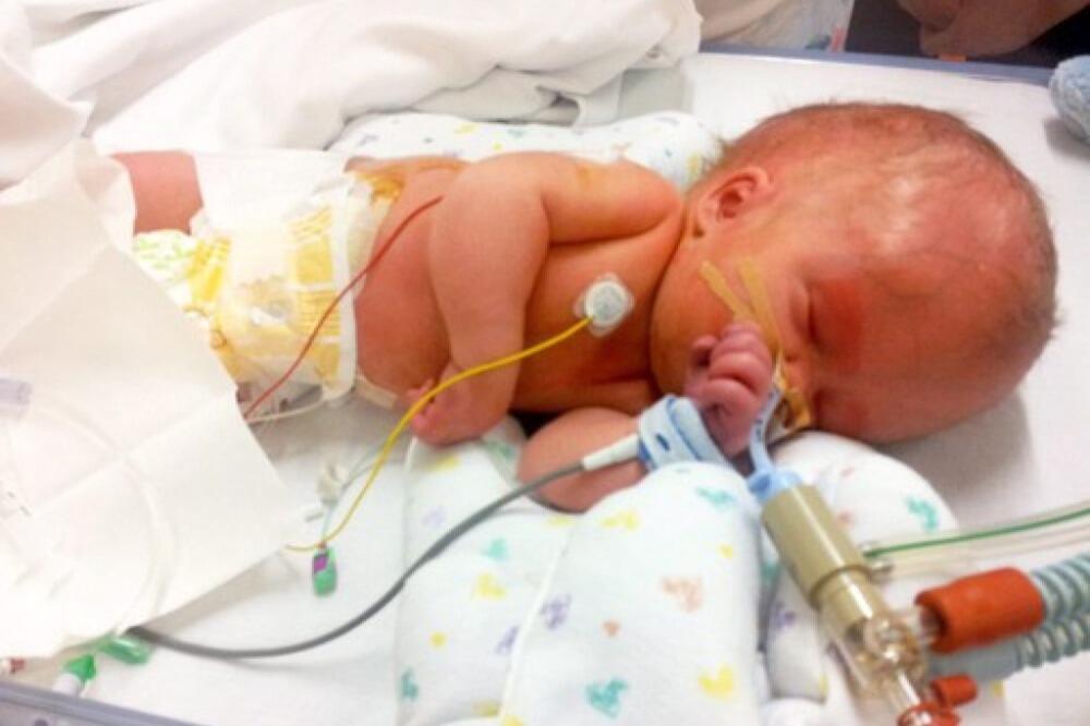 OVAJ DEČAK JE ROĐEN GOTOVO BEZ MOZGA: Smatraju ga FENOMENOM, a OVAKO izgleda danas (FOTO)