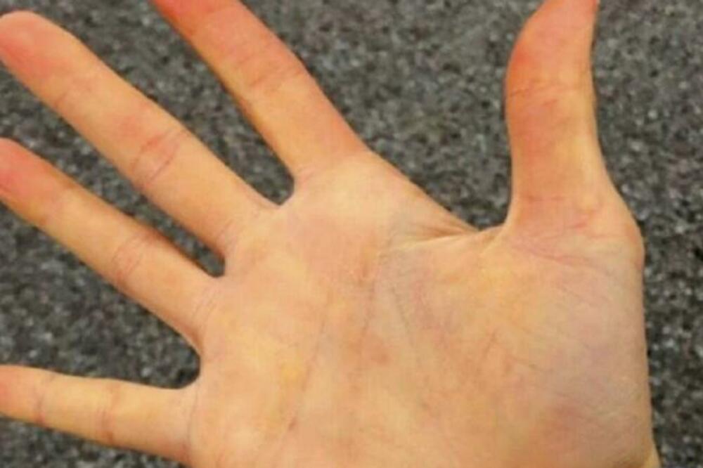 ULETEO U PROGRAM UŽIVO PA SE ZALEPIO ZA STO: Narapvio haos na televiziji, reagovala policija