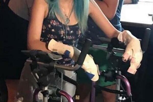 AJKULA JOJ OTKINULA NOGU I OBA PRSTA, BOL JE TRAJALA VEČNO: "Videla sam kost i zube na njoj" (FOTO)