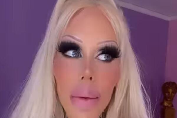 STAVILA U SEBE 3 KILOGRAMA PLASTIKE, I SAD LIČI NA OVO: Operisala je boga oca i ne zaustavlja se (FOTO)