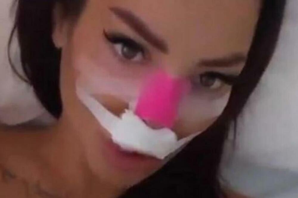 "ZBOGOM MAJKL DŽEKSONE!" Tamara Đurić posle SKANDALA SA DOKTOROM, ponovo otišla POD NOŽ! (FOTO)