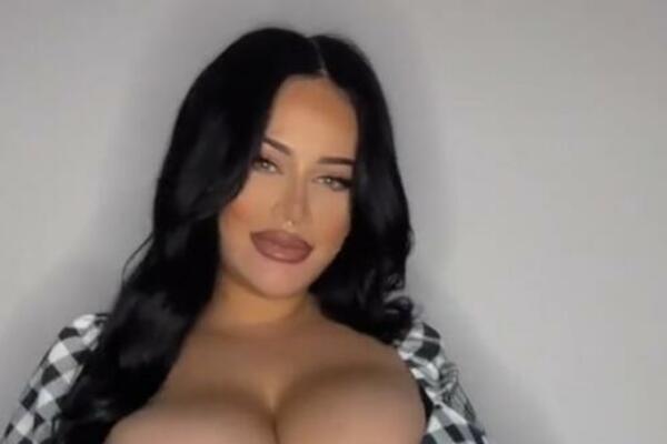 VELIKA PAMELIJA: Dobila nadimak samo zato što su joj RASLE KAO KVASAC, sad ne zna gde će!