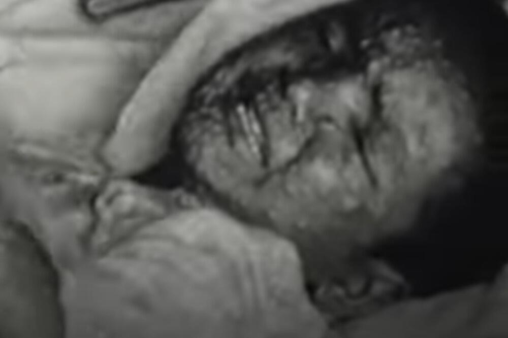 PITANJE KOJE MUČI JAVNOST: Da li je strah od MAJMUNSKIH BOGINJA opravdan?