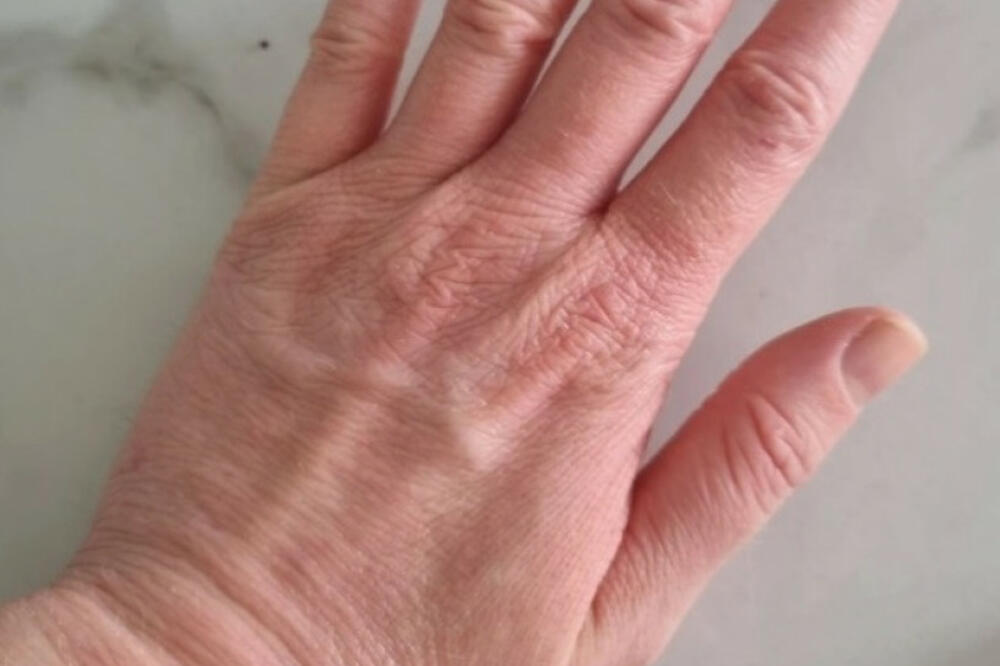 OVO SU GLAVNI UZROCI DRHTANJA RUKU! Jedan od njih može biti SMRTONOSAN PO VAS