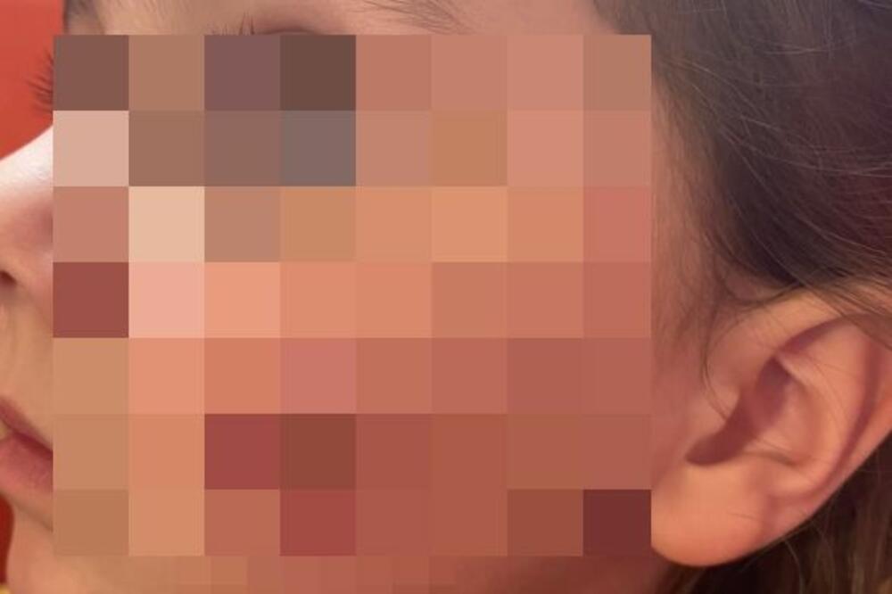 POLJUBILA ĆERKU I NAPRAVILA JOJ PAKAO OD ŽIVOTA: Trenutak nežnosti je DETE SKUPO KOŠTAO, ovo je ČIST HOROR! (FOTO)