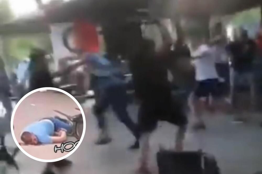 RAT U TIRANI! UŽASNE FOTOGRAFIJE: Povređenih na svakom koraku! STOLICA U GLAVU: Navijač leži u lokvi krvi! (FOTO)