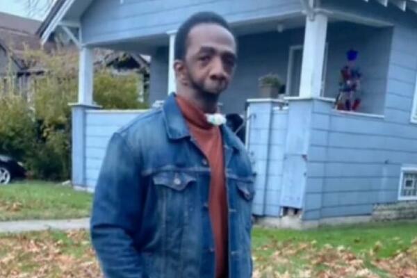 OVAJ ČOVEK NIKAD NIJE OKUSIO HRANU! Rođen je sa ozbiljnim DEFORMITETOM, svi UPIRU PRSTOM