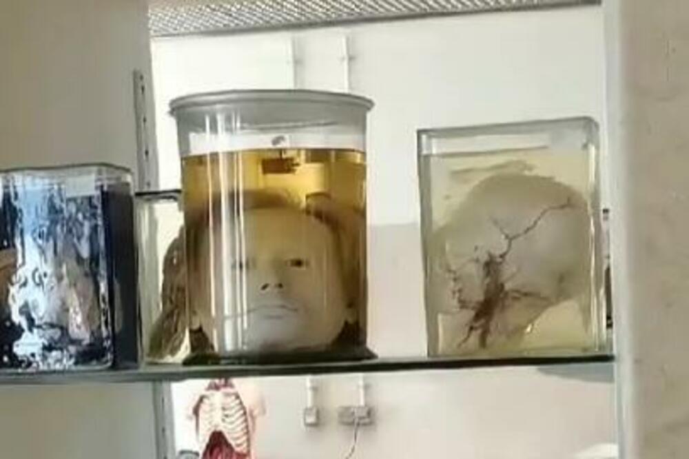 MISTERIJA LISABONSKE GLAVE: Stara je preko 2.000 godina, ZASTRAŠUJUĆE očuvana, a evo KOME je pripadala! (VIDEO)