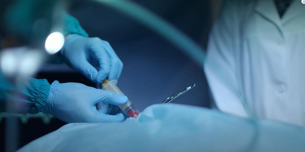 JOŠ JEDNA U NIZU USPEH SRPSKIH HIRURGA