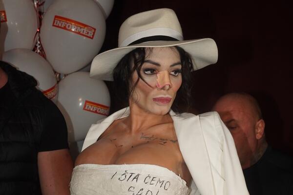 ZA MNOGE SRBE ONA JE NAJLEPŠA STARLETA: Uradila preko 100 operacija, a nekada je IZGLEDALA SKROZ DRUGAČIJE!