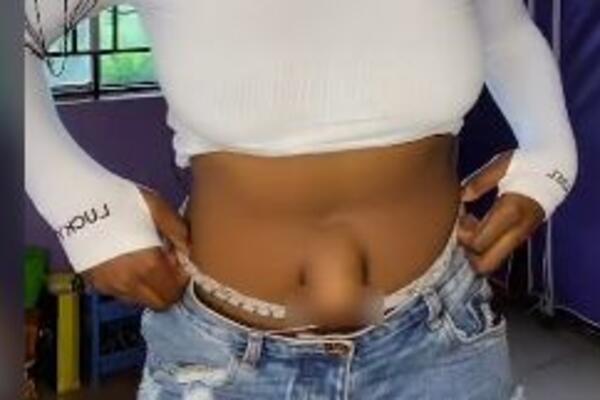 OVA DEVOJKA IMA NAJNEOBIČNIJI PUPAK NA PLANETI: Skinula se i pokazala, svima je JASNO (VIDEO)