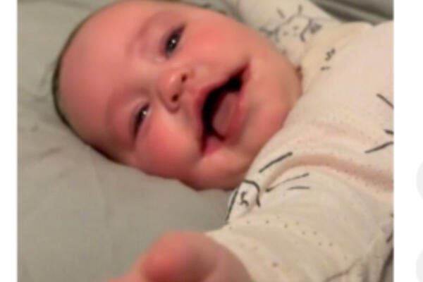 ROĐENA PRVA BEBA SA "VEČNIM OSMEHOM": Jedna je od 14 na svetu, OVAKO sada izgleda (VIDEO)