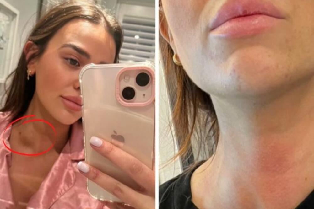 LEKAR JOJ NAPIPAO OVU STVAR, NIJE MOGLA DA DOĐE SEBI: Bivao je sve VEĆI I VEĆI (VIDEO)