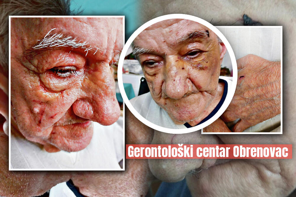 JELISAVETA JE DEMENTNOG OCA (82) ZATEKLA IZUDARANOG U DOMU ZA STARE: Za Espreso otkriva JEZIVE DETALJE (FOTO)