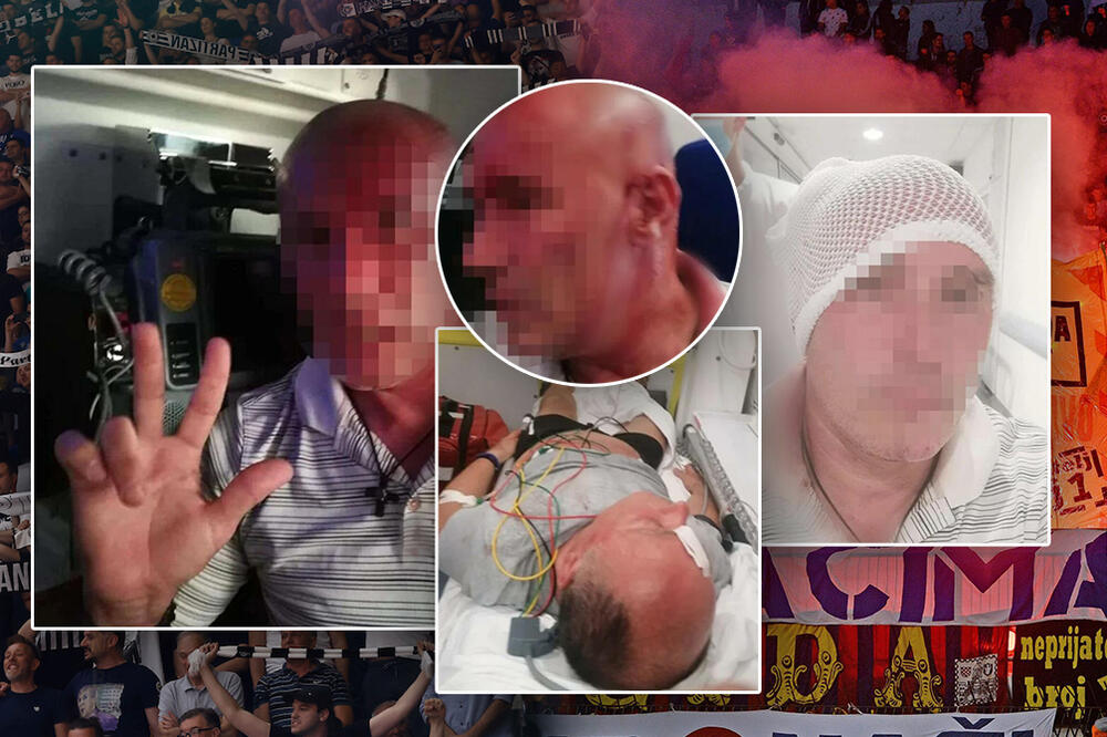 HULIGANI TORCIDE PRETUKLI DVOJICU GROBARA? Navijači završili razbijenih glava zbog majice! UZNEMIRUJUĆE FOTOGRAFIJE