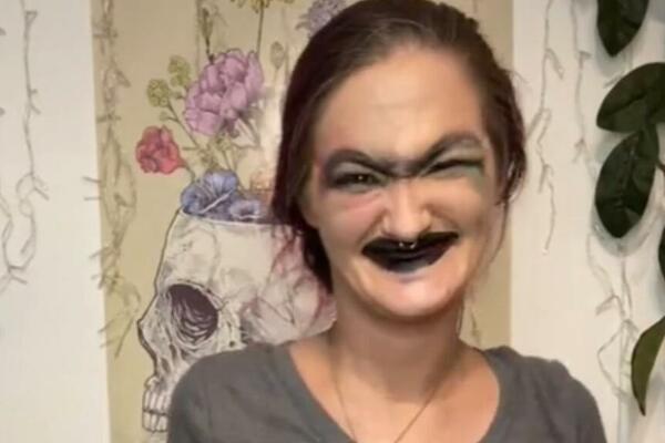 BILA JE ZAVISNIK OD DROGA, PA OSTALA BEZ ZUBA: Njena transformacija FRAPIRALA sve, OVO je ona? (VIDEO)