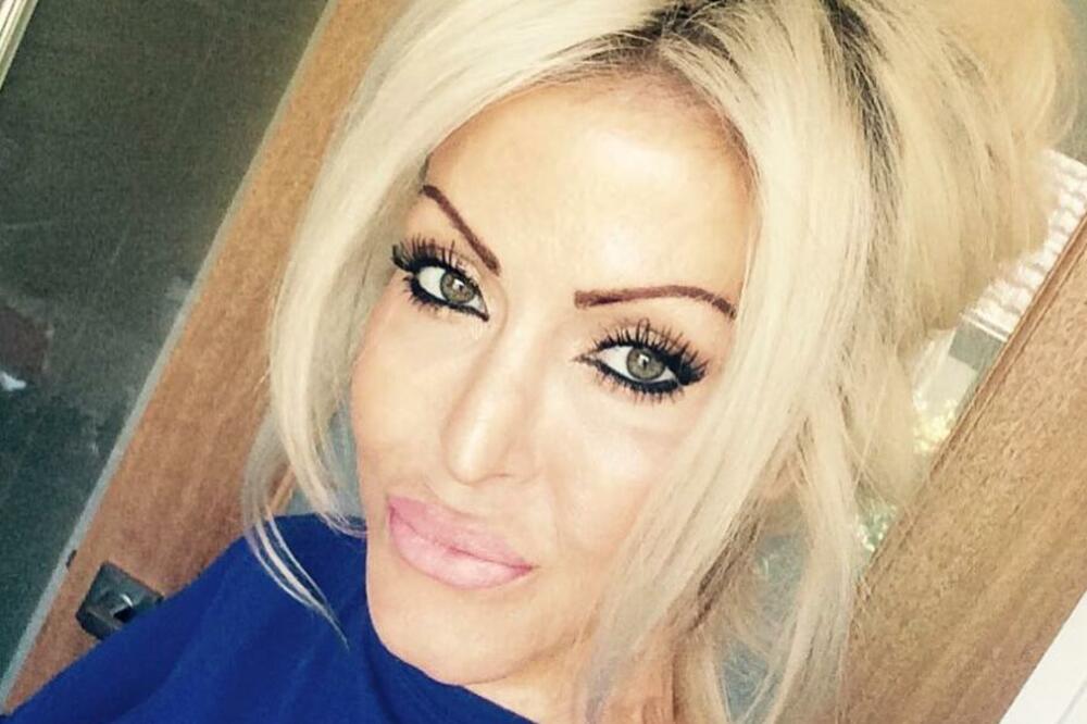 OVO JE SRPKINJA KOJU JE LJUBOMORNA ŽENA SPALILA DO GOLE KOŽE: Njeno LICE sada izgleda OVAKO (FOTO)