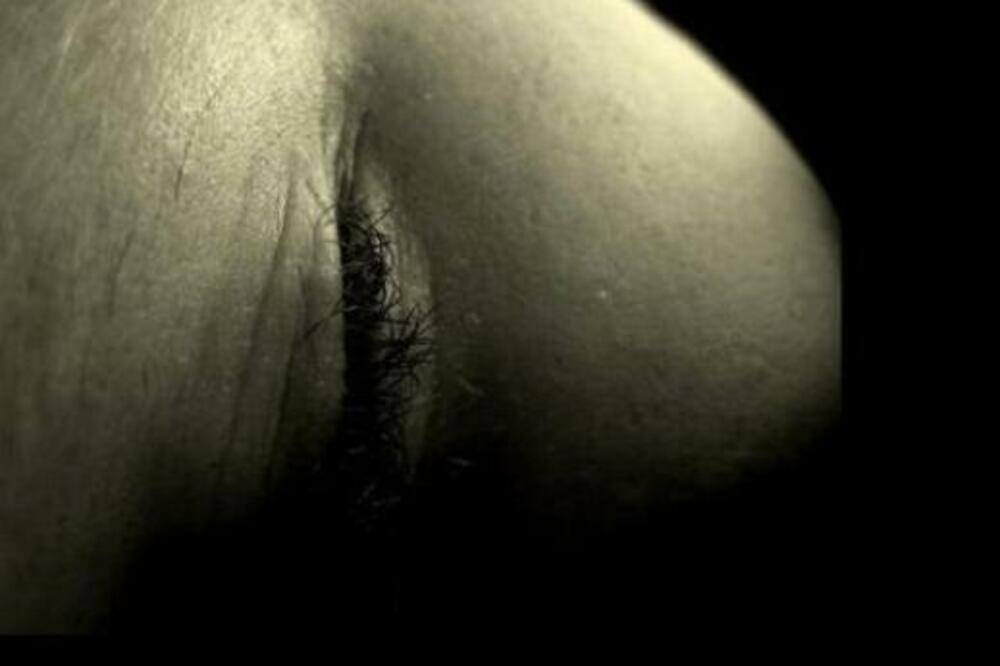 SVI GLEDAJU U VULGARNU STVAR NA SLICI: Čupavo i usko, ŠLOGIRAĆETE SE (FOTO)