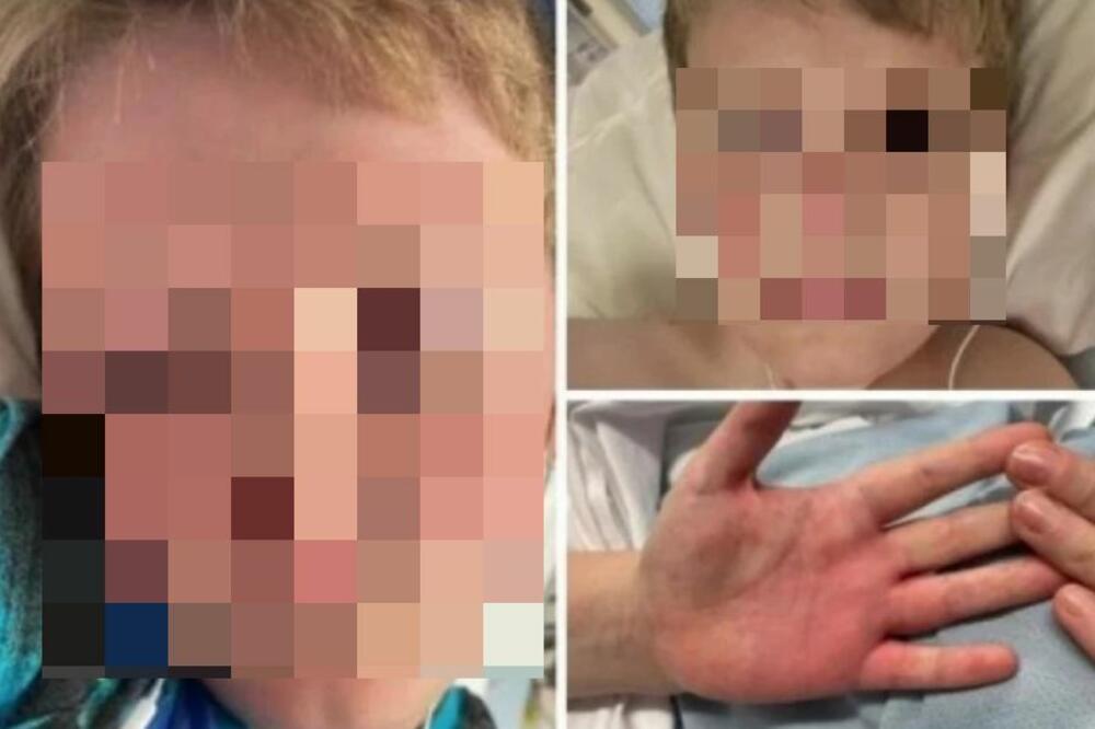 DEČAK PREŽIVEO PAKAO ZBOG PODMUKLIH SIMPTOMA: Nakon infekcije usledio je UŽAS, majka OČAJNA