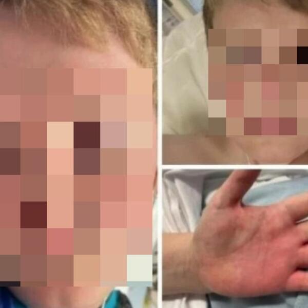 DEČAK PREŽIVEO PAKAO ZBOG PODMUKLIH SIMPTOMA: Nakon infekcije usledio je UŽAS, majka OČAJNA