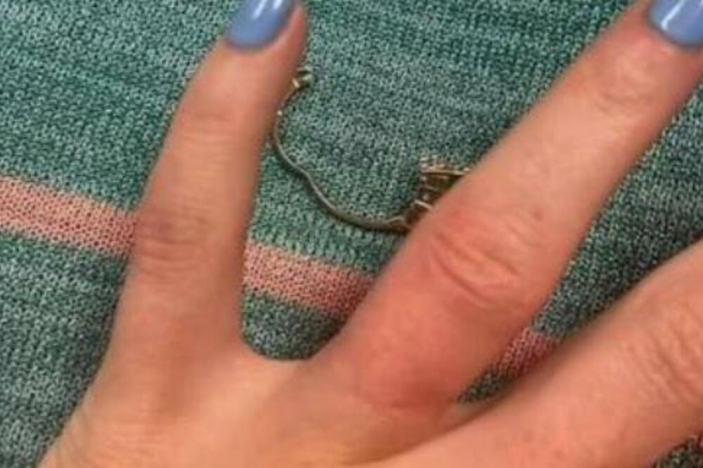 AKO IMATE OVAKAV MALI PRST, PRETI VAM GADNA STVAR: Može biti vrlo OZBILJNO I BOLNO ako ne reagujete na vreme