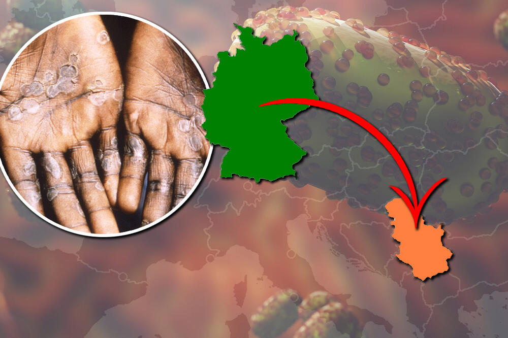 Nakon Švedske, majmunske boginje se pojavile i ovde: Epidemija buknula, u pitanju je smrtonosni soj "mpox klase 1!"