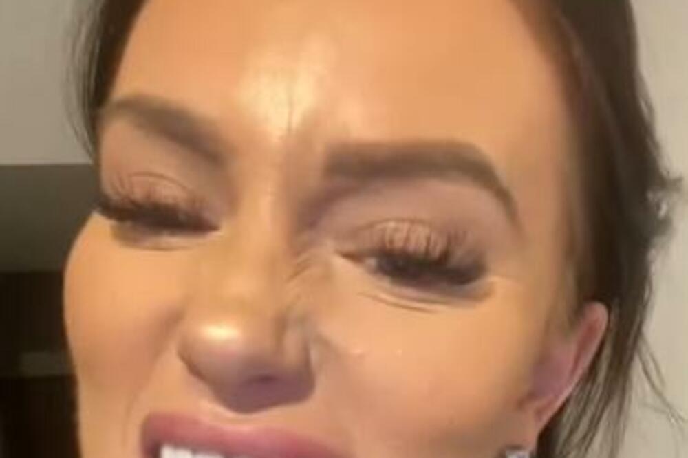 STAVILA NA SEBE VEŠTAČKU STVAR OD 230 EVRA! Pogledajte na šta sad LIČI, "modro je i neprirodno" (VIDEO)