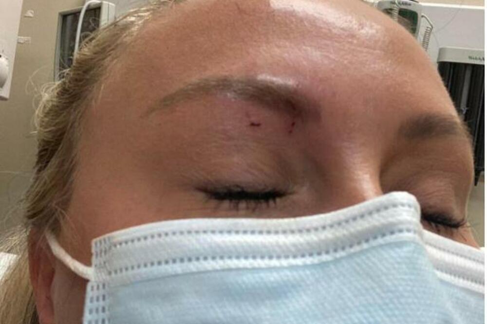 "OTVORILA SAM VRATA I SAMO ME JE ŠČEPALA"! Mara je doživela HOROR, ujed se vidi na njenom licu, UZNEMIRUJUĆE