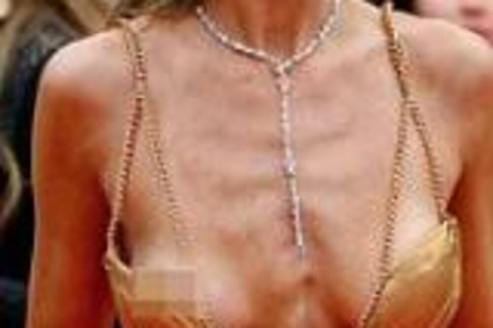 PLEMKINJI ISPALE GOLE GRUDI I ZADNJICA PRED SVIMA, ZA OVO TREBA ŠEĆER I VODA: Bruka kakva se ne pamti (FOTO)