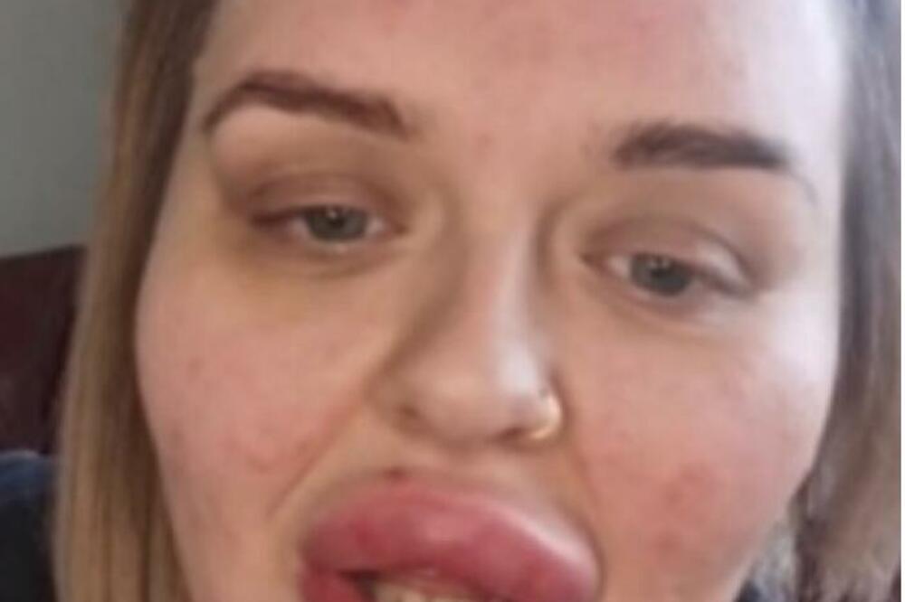 ŽELELA JE DA IH NAPUNI I UVEĆA, ZBOG REZULTATA LJUDI SU POPADALI: Doktor je odmah IMAO REAKCIJU (VIDEO)