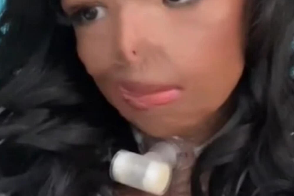 ZBOG ŠAMPONA JOJ SE BORILI ZA ŽIVOT: Upozorenje svima koji koriste ISTI, bila je U KOMI (UZNEMIRUJUĆI VIDEO)