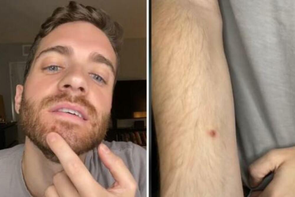 OVAJ DEČKO JE PRVI OBJAVIO SNIMAK SA MAJMUNSKIM BOGINJAMA: Jedna stvar ga RAZBESNELA, morao je... (VIDEO)