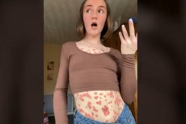 DEVOJKA FRAPIRALA SVE ONIM ŠTO JOJ JE NA TELU, LJUDI ZURE U NJU: Ima ih svuda, ponosi se TIME! (VIDEO)