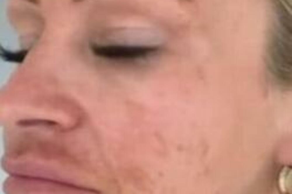 ZABORAVILA JE DA SE NAMAŽE, PA JOJ SE DESILA GROZNA STVAR: Kada je pogledala na VRH, sledila se (FOTO)